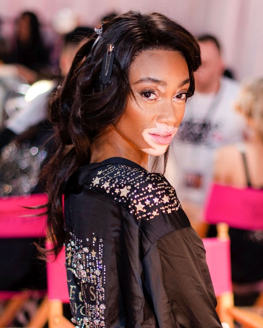 ESC: Victoria's Secret, Winnie Harlow